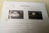 6次彩超产检正常,四川家庭为何生下手足畸形儿